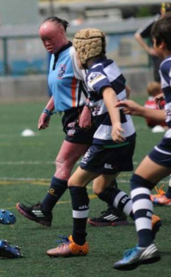 Escondió su rostro por 22 años