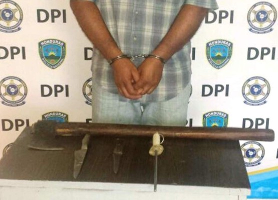 Hombre que vendía carne de burro podría pasar cinco años en prisión