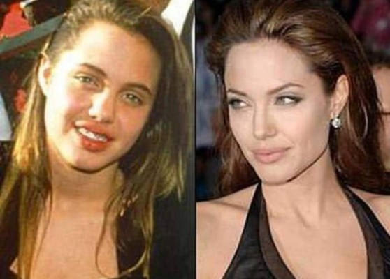 Celebridades antes de la fama: Las fotos que muchos no quieren que veas&nbsp;&nbsp;