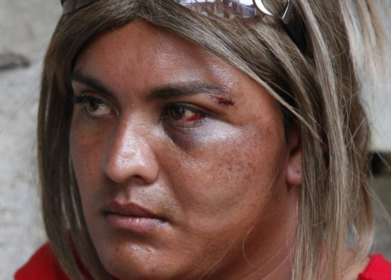Pleito entre médico y travesti enciende debate en Honduras
