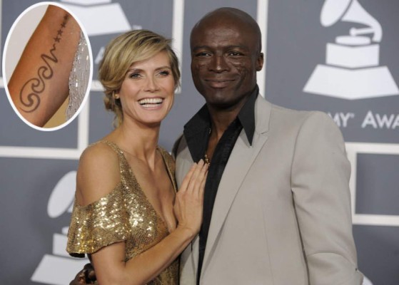 Borraron de su piel los amores del pasado plasmados en tatuajes