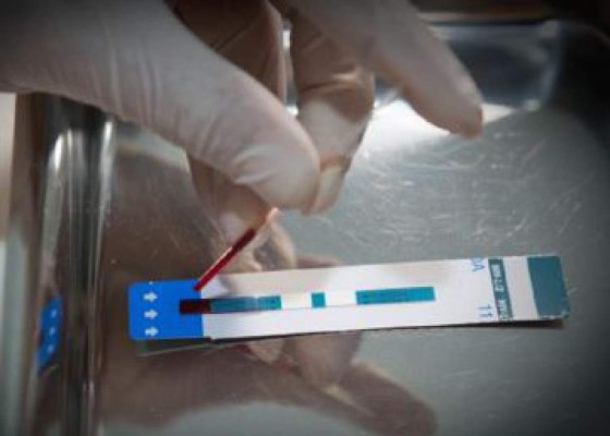 Elevan a CorteIDH caso pacientes VIH/SIDA en Guatemala&nbsp;