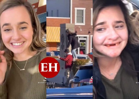 ¡Oops! Joven pierde sus dientes tras realizar reto en TikTok