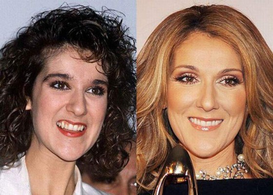 Celebridades antes de la fama: Las fotos que muchos no quieren que veas&nbsp;&nbsp;