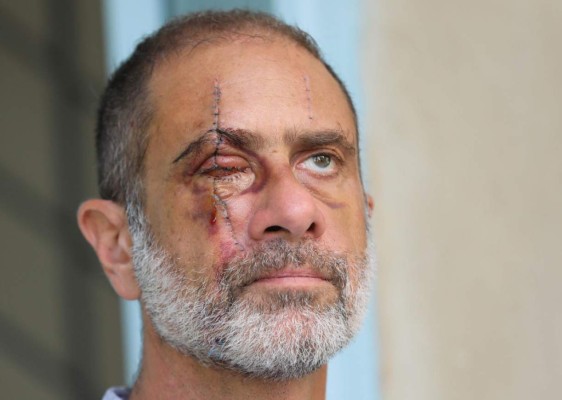 FOTOS: Duros testimonios de sobrevivientes a brutal explosión en Beirut&nbsp;&nbsp;