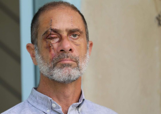 FOTOS: Duros testimonios de sobrevivientes a brutal explosión en Beirut&nbsp;&nbsp;