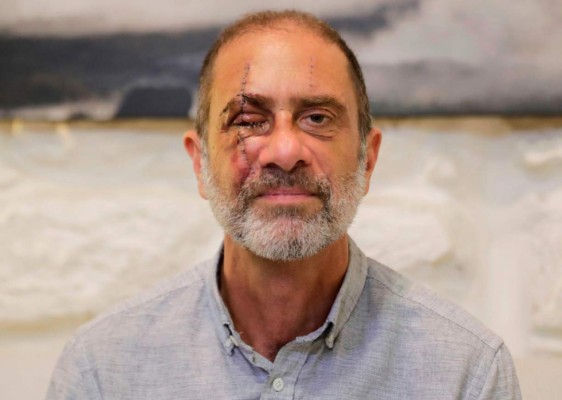 FOTOS: Duros testimonios de sobrevivientes a brutal explosión en Beirut&nbsp;&nbsp;