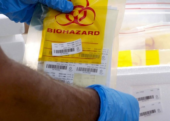 Revelan primeros resultados de la vacuna rusa contra el coronavirus  