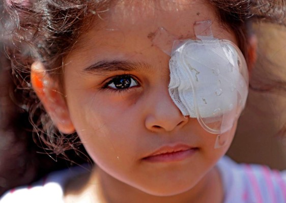 FOTOS: Duros testimonios de sobrevivientes a brutal explosión en Beirut&nbsp;&nbsp;