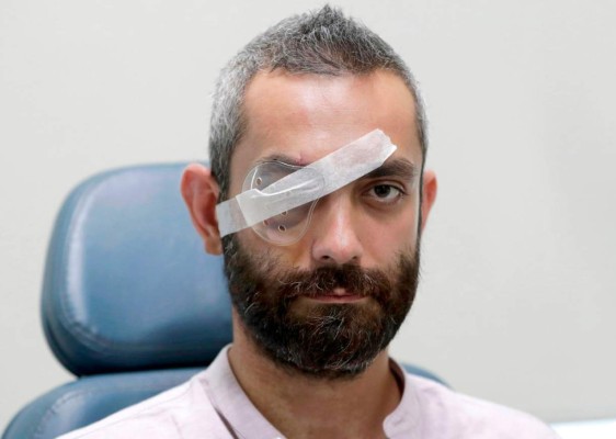 FOTOS: Duros testimonios de sobrevivientes a brutal explosión en Beirut&nbsp;&nbsp;