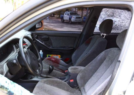 Tirotean a implicado en corrupción en el IHSS