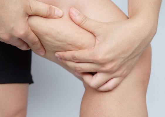 Ocho ejercicios para eliminar la celulitis en piernas y glúteos&nbsp;&nbsp;