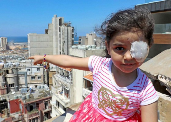 FOTOS: Duros testimonios de sobrevivientes a brutal explosión en Beirut&nbsp;&nbsp;