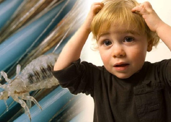 Remedios caseros para eliminar piojos y liendres de forma rápida