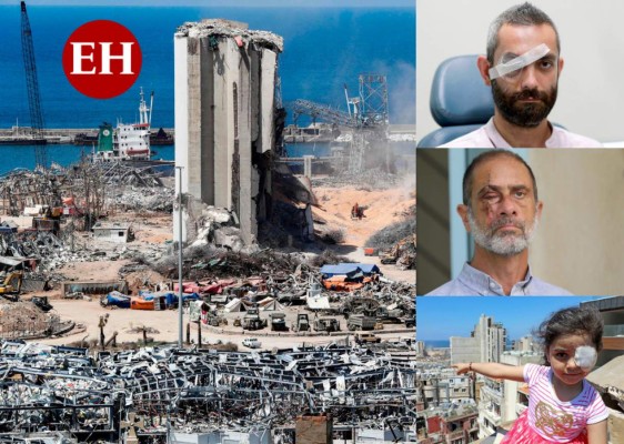 FOTOS: Duros testimonios de sobrevivientes a brutal explosión en Beirut&nbsp;&nbsp;