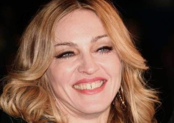 Famosos con sonrisas imperfectas