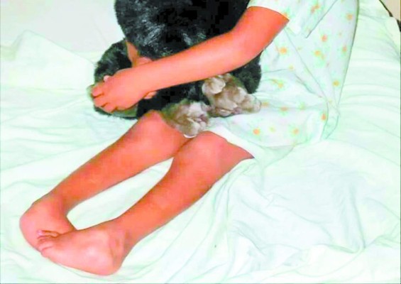 Corregirán pie equinovaro