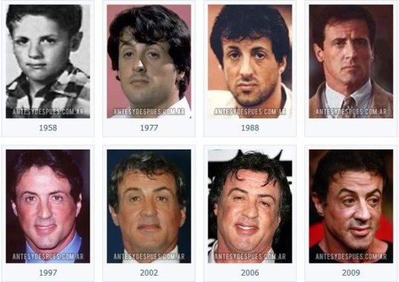 Cirujanos plásticos que hicieron desastres con los famosos