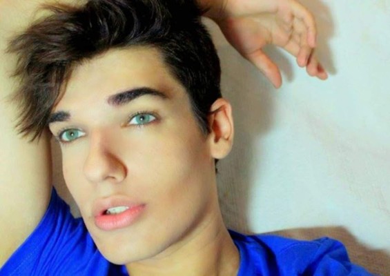 Muere el 'Ken humano' brasileño