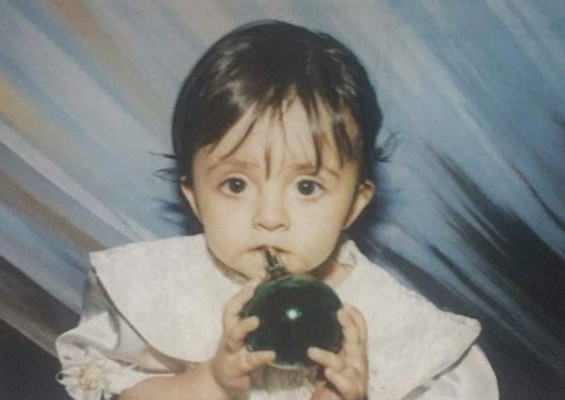 Revelan cómo era el rostro de 'Angelina Jolie zombie' antes de someterse a varias cirugías