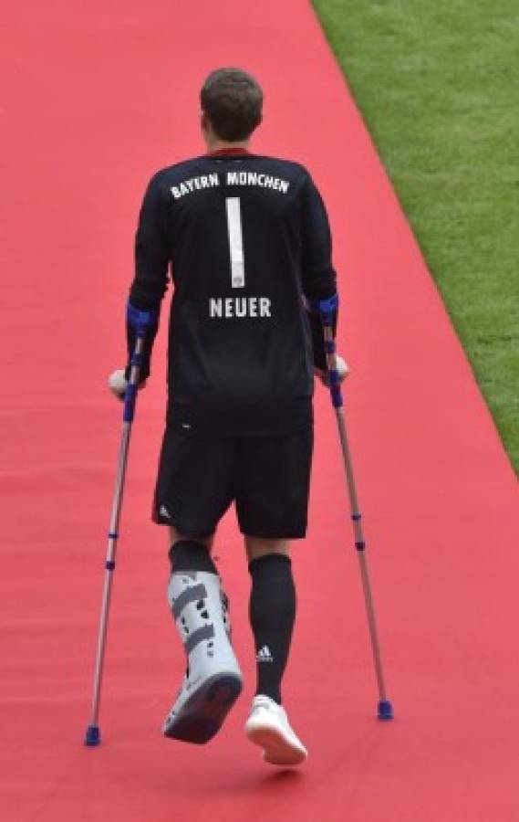 (FILES) This file photo taken on May 20, 2017 shows Bayern Munich's goalkeeper Manuel Neuer arriving on crutches for the trophy celebration after the German first division Bundesliga football match FC Bayern Munich vs SC Freiburg in the southern German city of Munich.Bayern Munich's goalkeeper and captain Manuel Neuer said on October 7, 2017 that he could in the end be out until March 2018 having undergone another operation on September 19 after again fracturing his left foot. / AFP PHOTO / Guenter SCHIFFMANN / RESTRICTIONS: DURING MATCH TIME: DFL RULES TO LIMIT THE ONLINE USAGE TO 15 PICTURES PER MATCH AND FORBID IMAGE SEQUENCES TO SIMULATE VIDEO. == RESTRICTED TO EDITORIAL USE == FOR FURTHER QUERIES PLEASE CONTACT DFL DIRECTLY AT + 49 69 650050