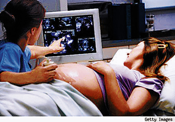 Las primeras imágenes del bebé