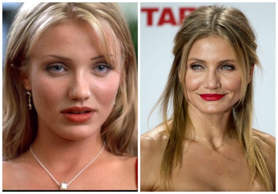 Famosos que dejaron de ser patitos feos para convertirse en cisnes