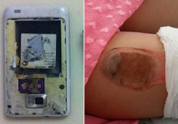 Explota Samsung Galaxy S2 en bolsillo de niña y le deja quemaduras