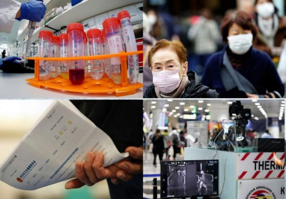 Las preguntas y respuestas científicas sobre el coronavirus