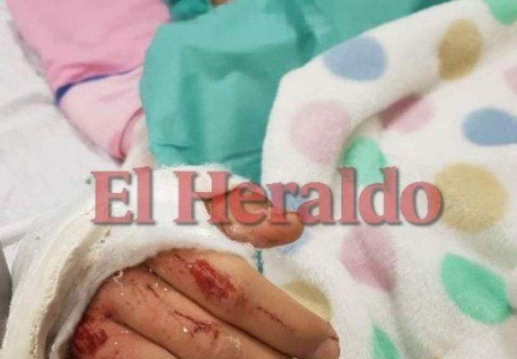 Sobreviviente de derrumbe en Los Llanos: 'Logré sacar la mano para hacer señas y así me lograron ver'