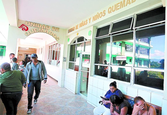 Niños quemados requieren ayuda