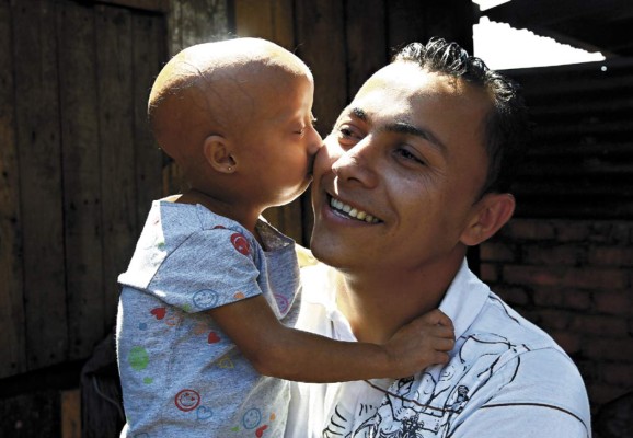 Stefani, una niña atrapada en el cuerpo de una anciana