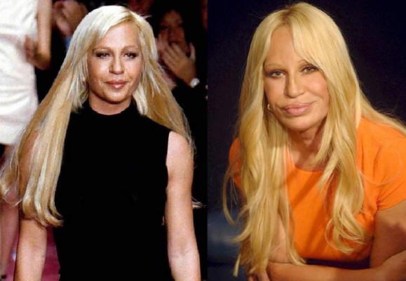 Famosos que lucen terribles después de las cirugías