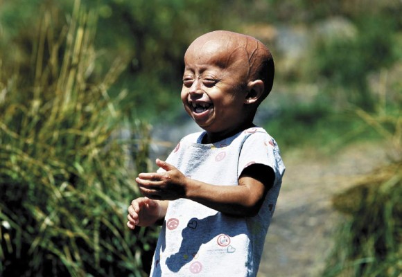 Stefani, una niña atrapada en el cuerpo de una anciana