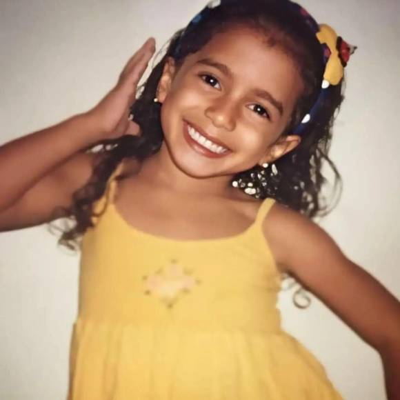 Rinosplatia, reducción de pechos y remoción de quijada: el cambio físico de Anitta gracias a las cirugías plásticas