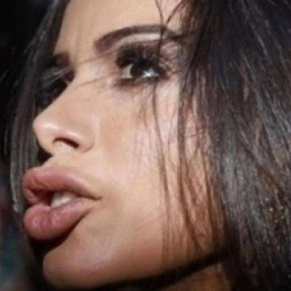 Rinosplatia, reducción de pechos y remoción de quijada: el cambio físico de Anitta gracias a las cirugías plásticas