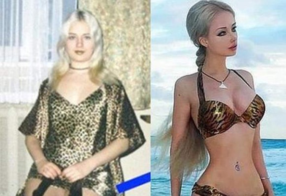 Así lucía la ''Barbie humana'' antes de las cirugías