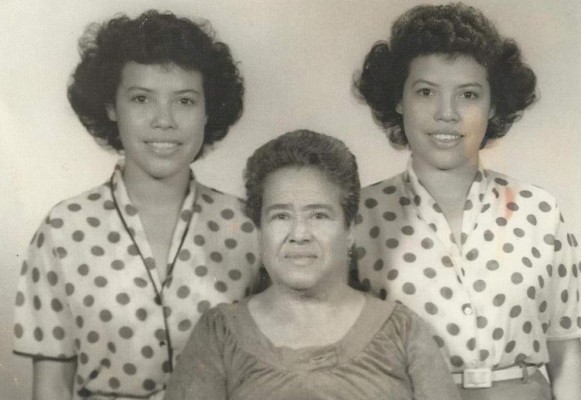 'Fue muy duro separarme de mi hermana gemela'