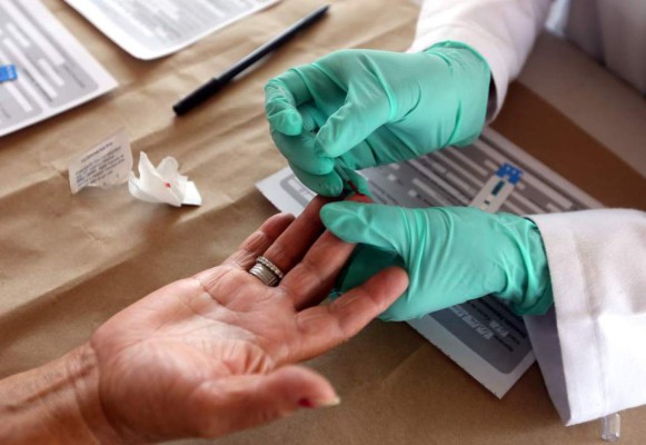 Tres personas son diagnosticadas con VIH al día en Honduras &nbsp;&nbsp;