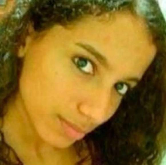 Rinosplatia, reducción de pechos y remoción de quijada: el cambio físico de Anitta gracias a las cirugías plásticas