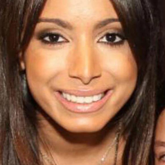 Rinosplatia, reducción de pechos y remoción de quijada: el cambio físico de Anitta gracias a las cirugías plásticas