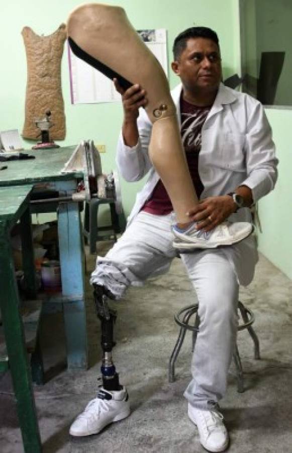 Emigrantes hondureños mutilados por las ruedas de La Bestia salen adelante gracias a fundación