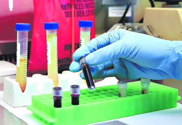 Un millón de lempiras ha invertido la UNAH para detectar el virus del zika