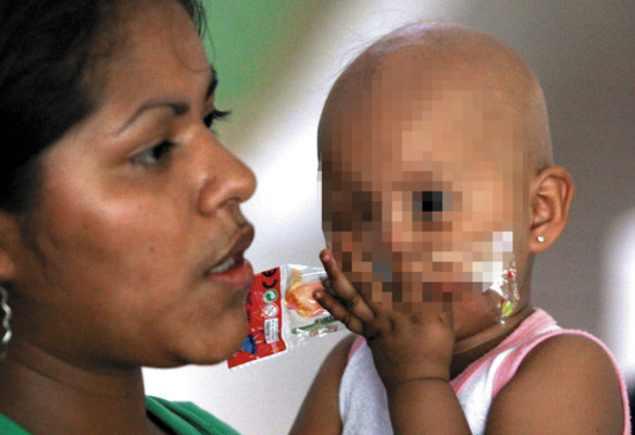 Al año reportan 300 casos de cáncer de ojo en Honduras