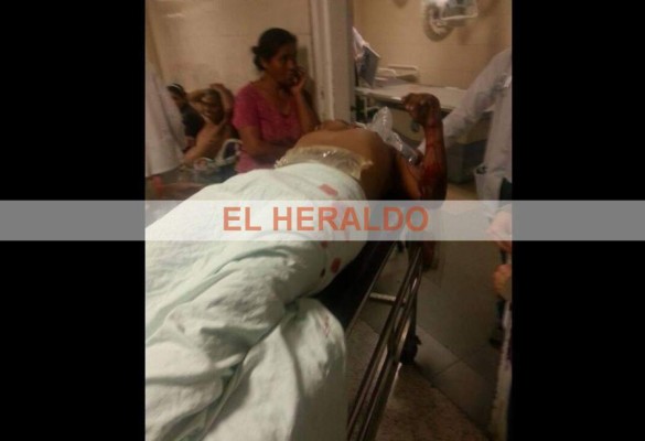 Nueve estudiantes heridos dejan violentas protestas en Tegucigalpa