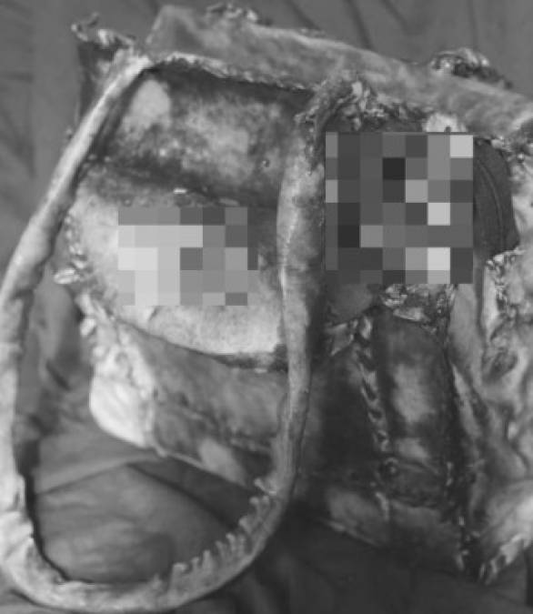 Collar de narices, cinturón de pezones y lámpara de piel humana: Artesanías que hacía un asesino con restos de sus víctimas (FOTOS)