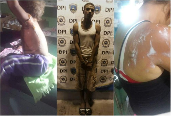 Salvaje hombre quema con agua caliente a su mujer e hija en Santa Bárbara