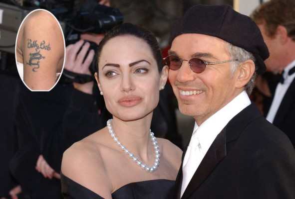 Borraron de su piel los amores del pasado plasmados en tatuajes