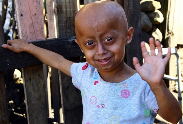 Stefani, una niña atrapada en el cuerpo de una anciana