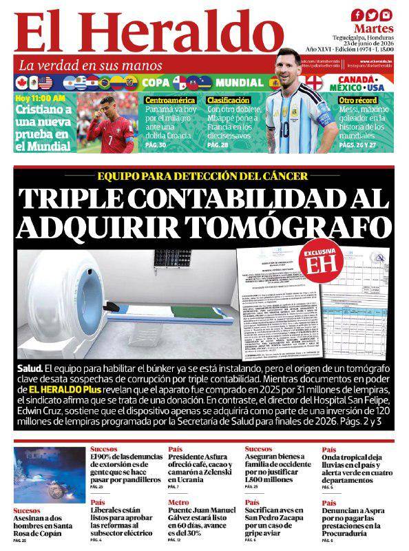 Triple contabilidad al adquirir tomógrafó en el San Felipe